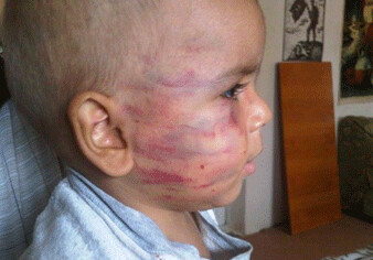 В Баку жестоко избивается ребенок (ФОТО)