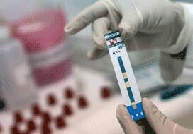 Будет увеличено количество центров добровольного тестирования и определения ВИЧ-статуса