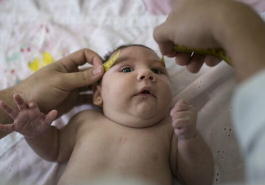 Вирус Зика: женщин Бразилии просят отложить беременность
