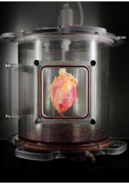 Учeные впервые вырастили в лаборатории человеческое сердце