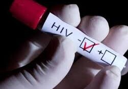 Число новых случаев заражения ВИЧ - в Азербайджане