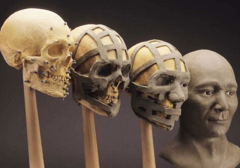 Биоинженеры вырастили живую кость для реконструкции лица