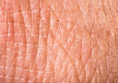 Разработан новый способ выращивания человеческой кожи