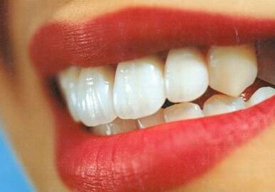 Ваше сиятельство: продукты, которые делают зубы белее