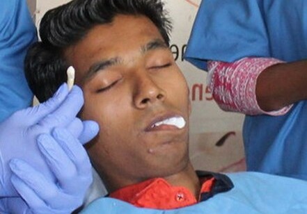 Индийскому подростку удалили самый длинный в мире зуб