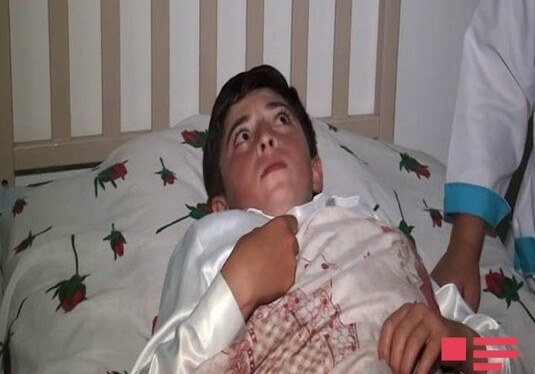 ВС Армении обстреляли азербайджанское село, ранен 13-летний мальчик (Фото)