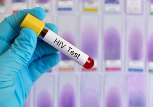 Ученые разработали антитела, убивающие 99% штаммов ВИЧ