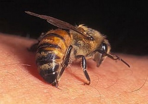 В Баку после укуса пчелы скончался мужчина