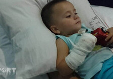 В Сумгайыте мясорубка разрубила пальцы ребенка (Фото) 