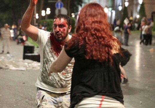 Число пострадавших в ходе протестов в Тбилиси превысило 60 человек