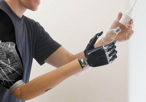 Беспроводные имплантаты позволили пациентам управлять протезом руки