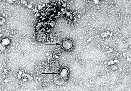 Китай опубликовал первый снимок нового коронавируса