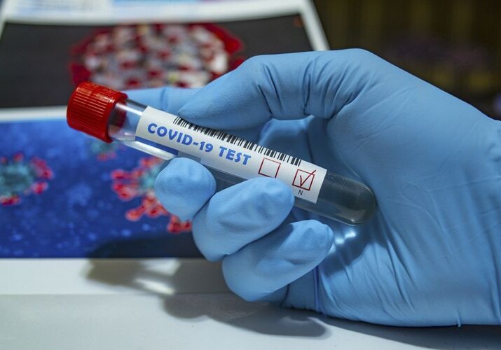 В Азербайджане выявлено еще 149 случаев заражения коронавирусом